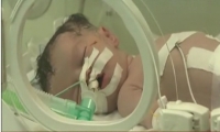 الطفلة شيماء ولدت من رحم الشهيدة شيماء رغم مرور وقت على إستشهادها