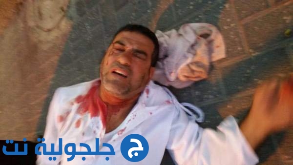 اعتداء على المواطن عماد أبو شرخ من اللد من قبل مستوطنون 